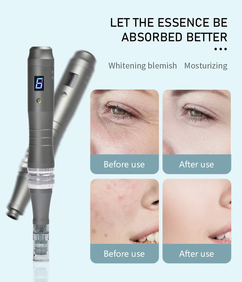 Dr Pen Microneedling Pen