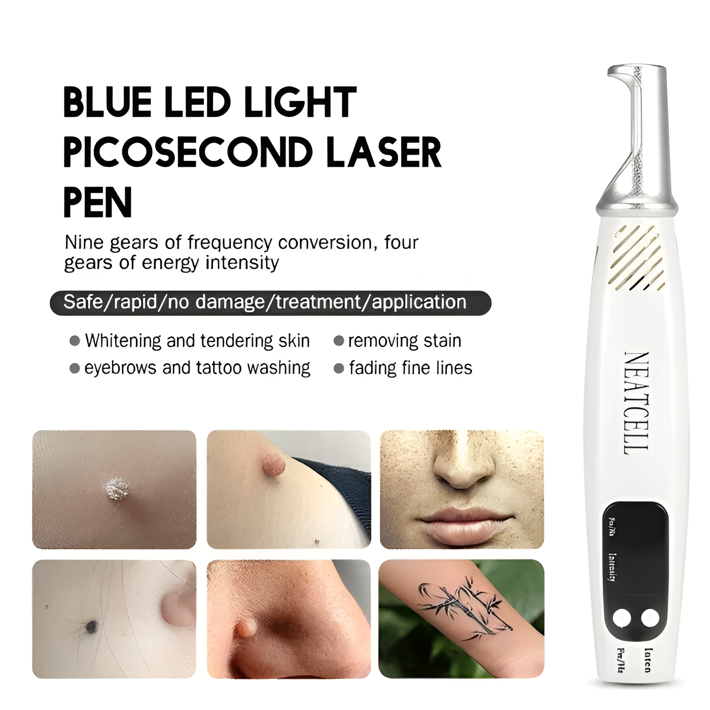 Laser Tattoo Removal Pen - Fade ink by 40% in 3 sessions