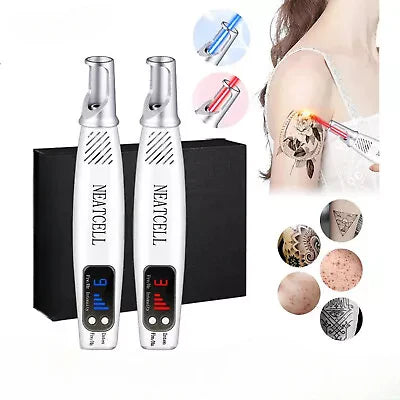 Laser Tattoo Removal Pen - Fade ink by 40% in 3 sessions