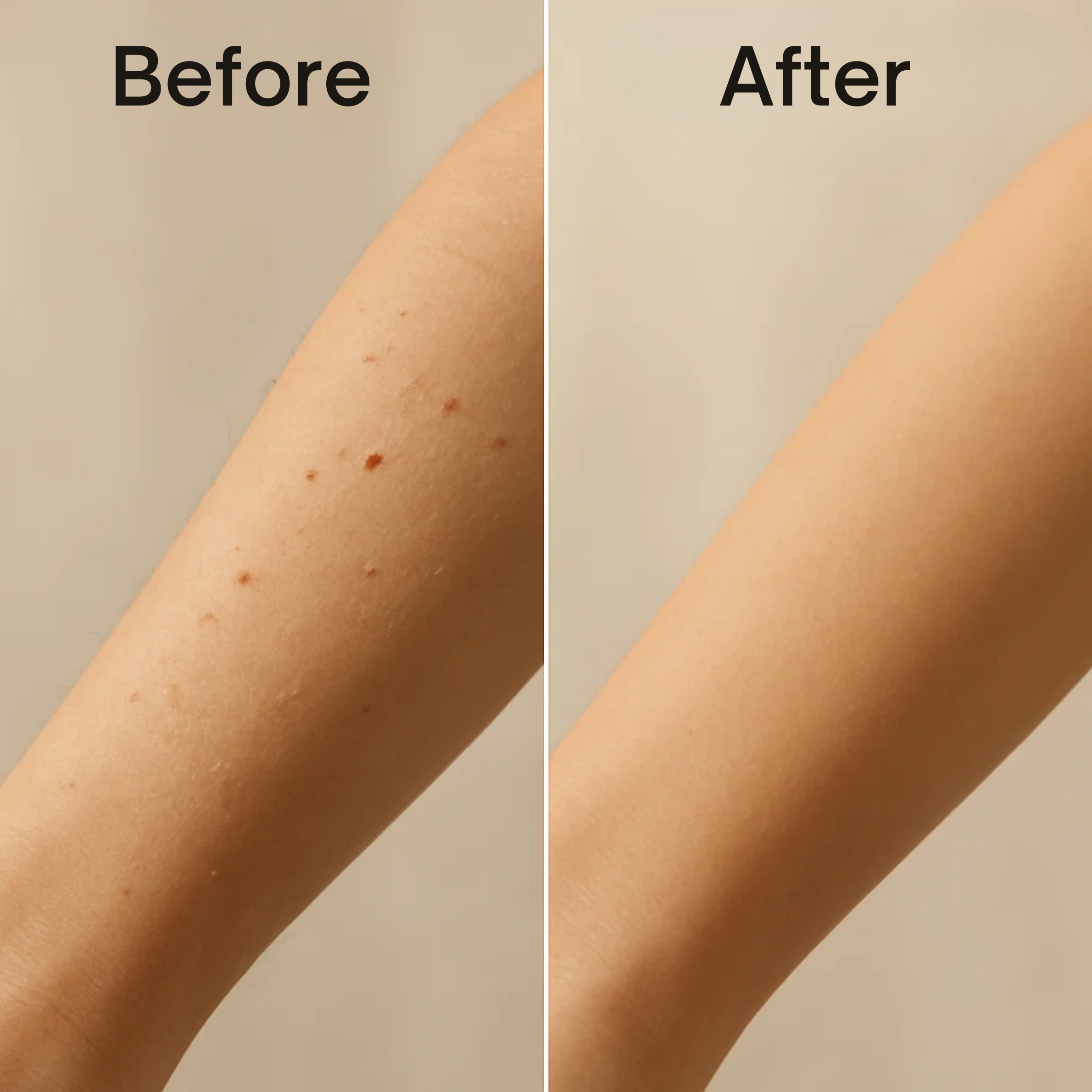 BeeSmooth – Banish Skin Tags, Reveal Clear Skin