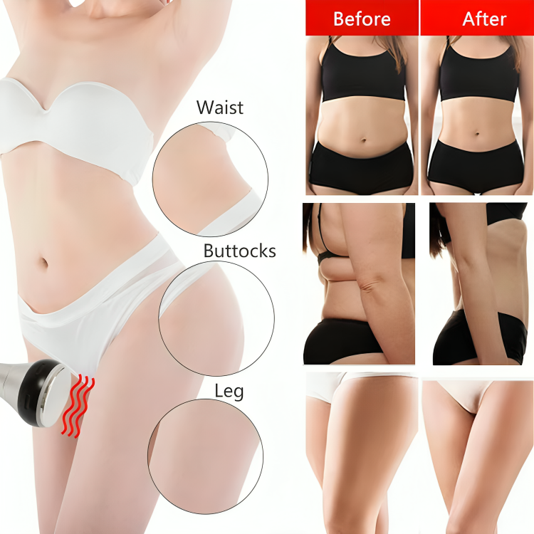 Ultrasonic Fat Cavitaion Machine