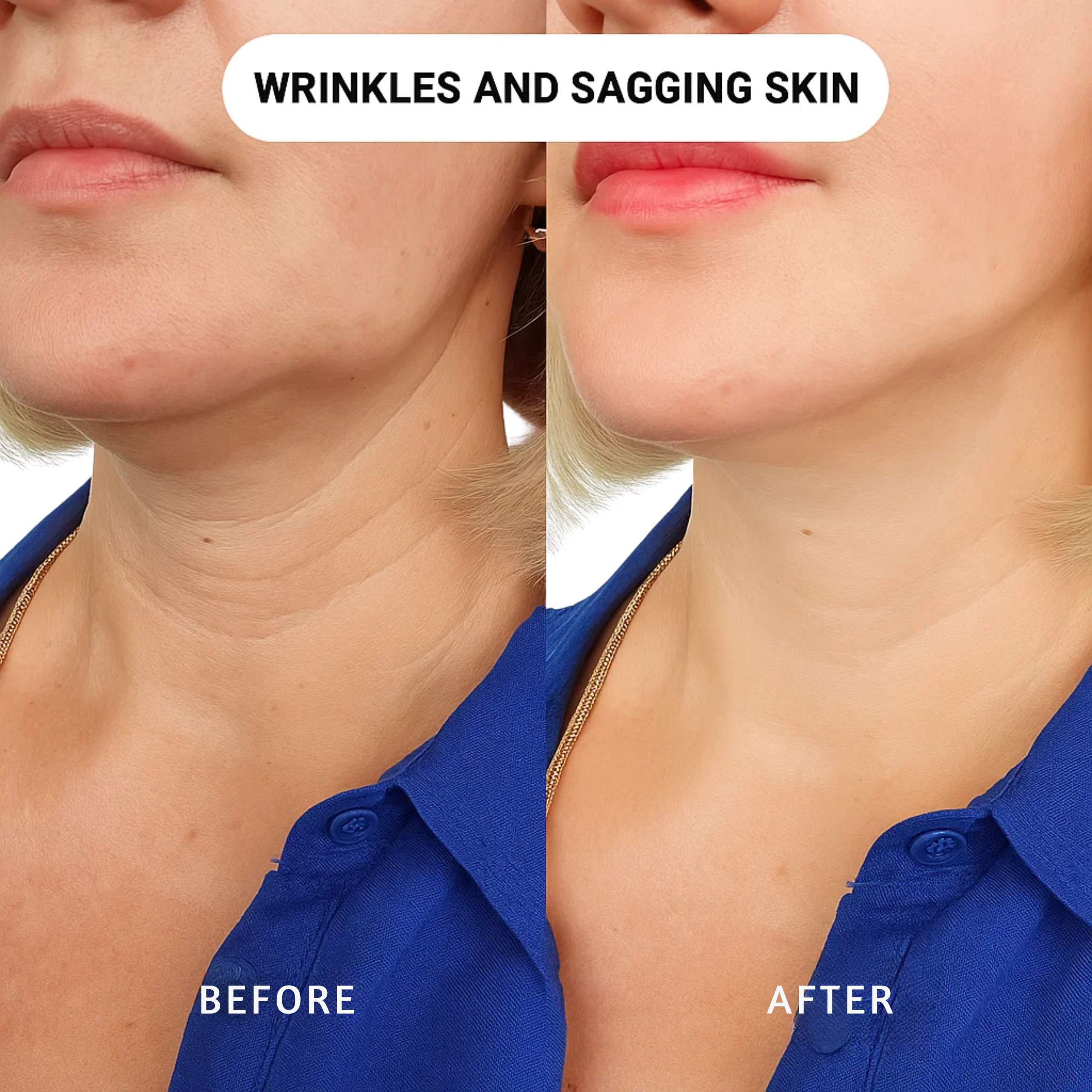 Micro-Infusion Anti-Aging Kit – Smooth Wrinkles, Restore Firm Youthful Skin