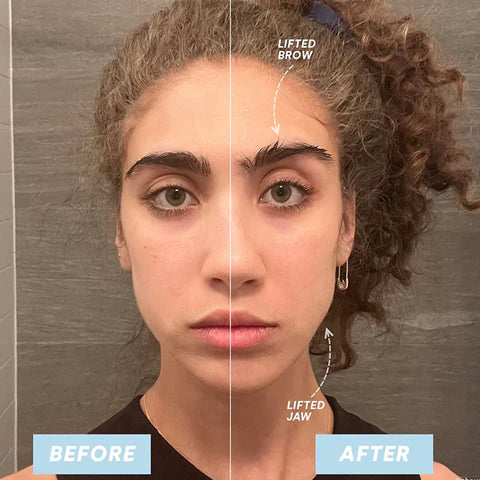 MicroLift ™- Microcurrent Face Lifter